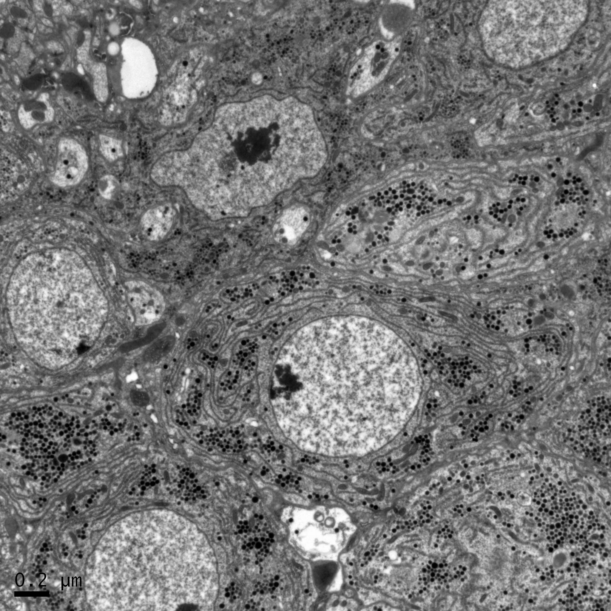 透射電鏡：分泌致密型突觸囊泡的神經(jīng)元