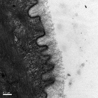 透射電鏡：一種動物的表皮1 Small Small