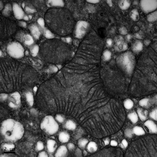 透射電鏡：一種藥物使內質網腫脹而不影響線粒體1 Small Small