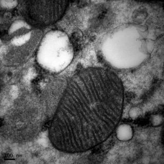 透射電鏡：一種藥物使內質網腫脹而不影響線粒體1 Small Small