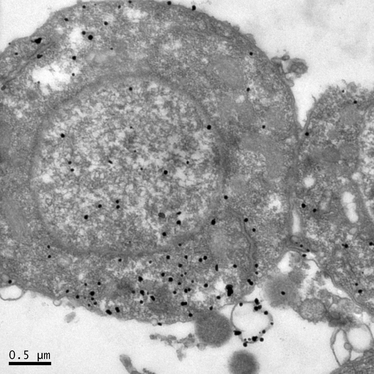 包埋前免疫電鏡：一種蛋白表達于核質和胞質 Large