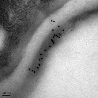 包埋后免疫電鏡： 一種表達于動物細胞部分幾丁質外殼的蛋白 2