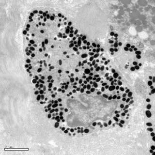 透射電鏡：一種動物的黑色素細胞 Small Small