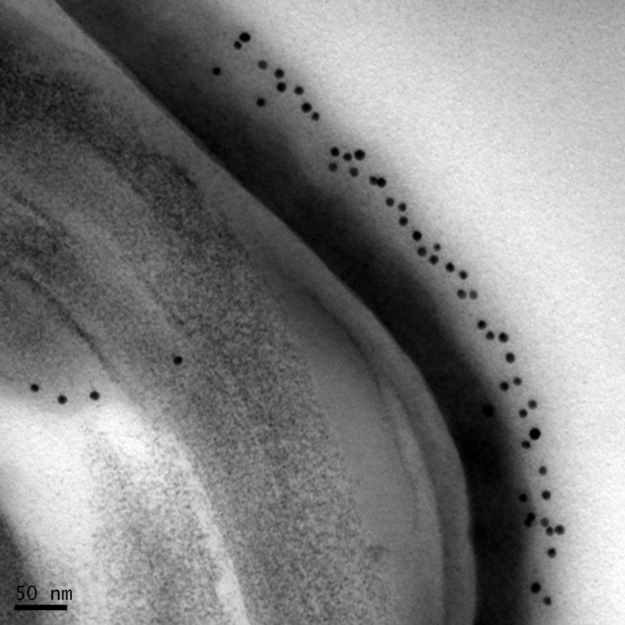包埋后免疫電鏡： 一種表達(dá)于動(dòng)物細(xì)胞幾丁質(zhì)外殼的蛋白