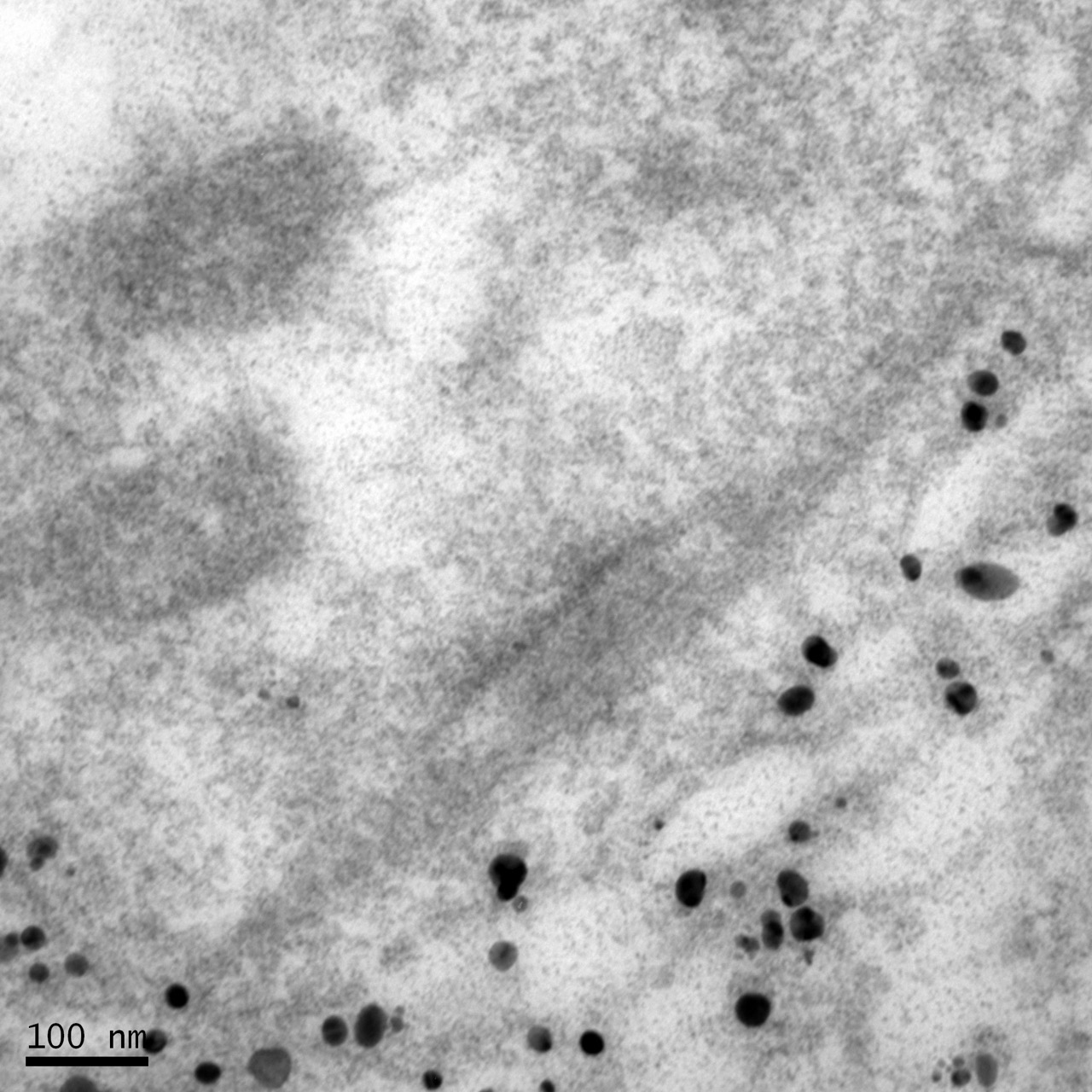 包埋前免疫電鏡：一種蛋白表達于突觸后區域 Large