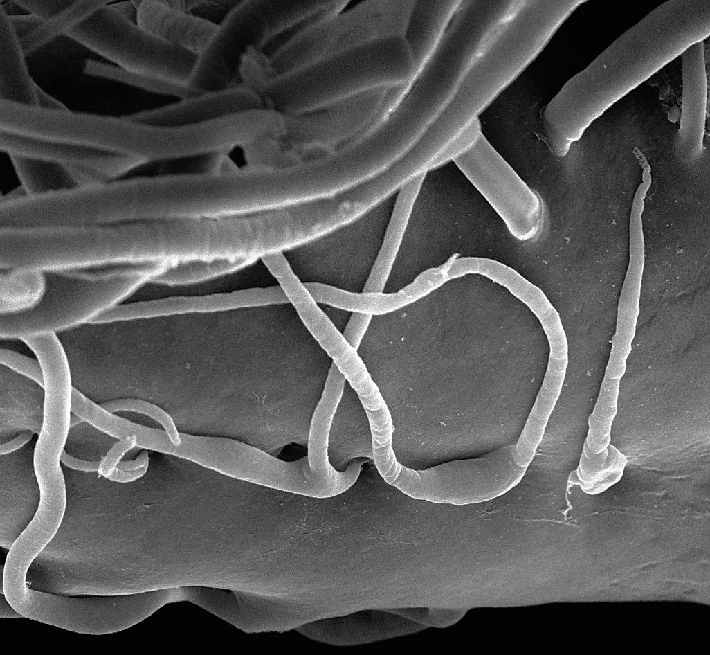 掃描電鏡：一種動物的神經纖維