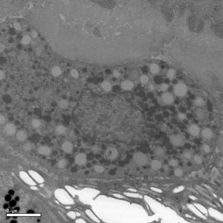 透射電鏡：一種動物的黃色素細胞1 Small Small