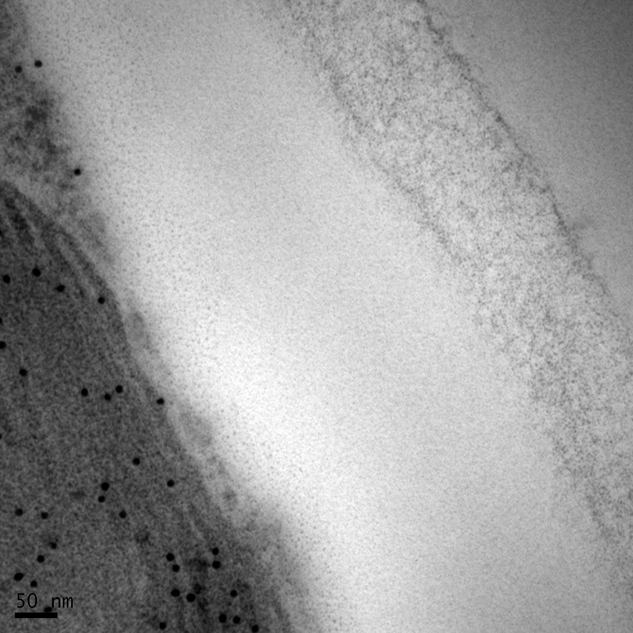 包埋后免疫電鏡： 一種表達于非細胞壁的蛋白