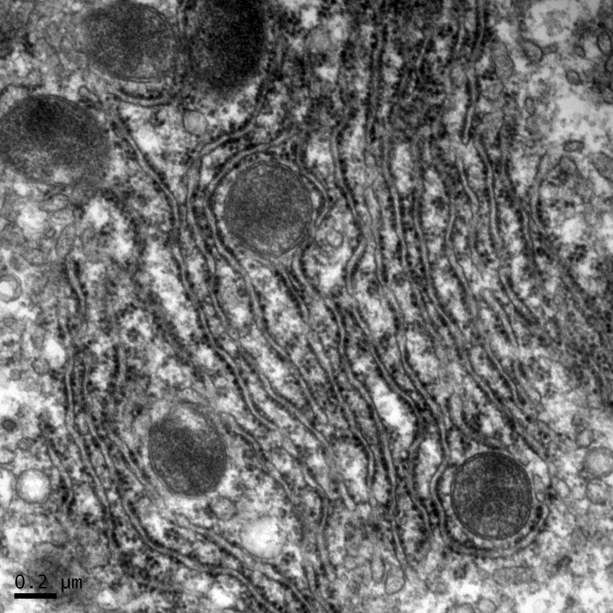 透射電鏡：內(nèi)質(zhì)網(wǎng)正常