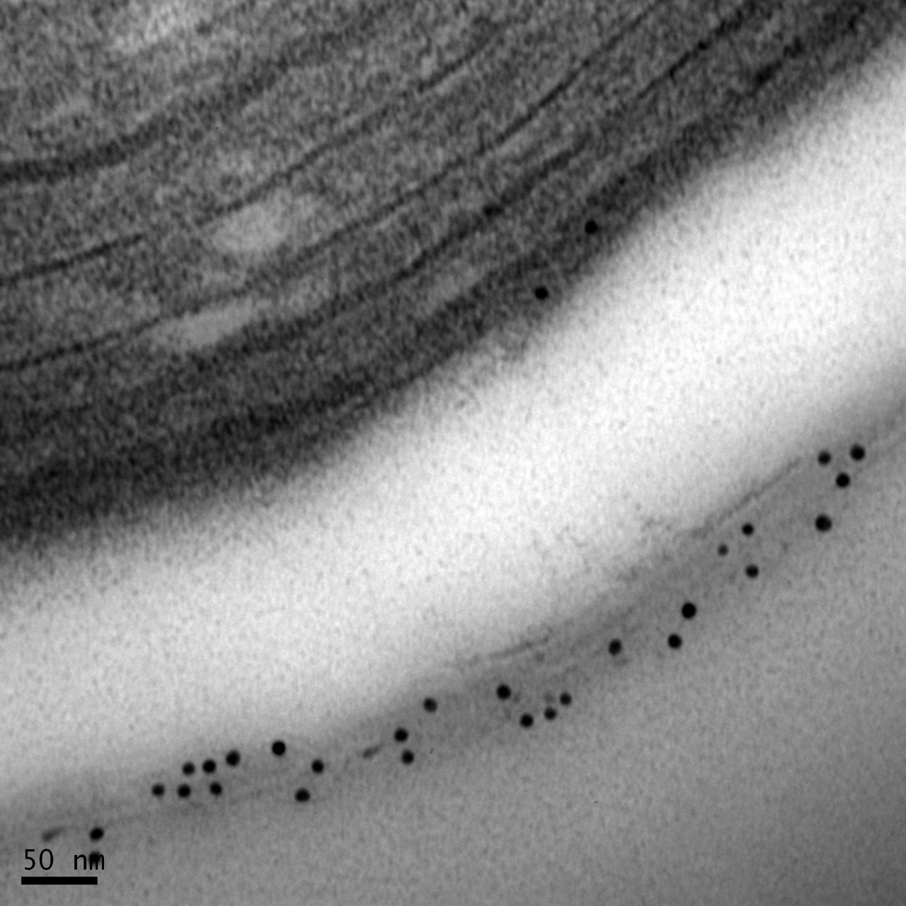 包埋后免疫電鏡： 一種表達于細胞壁的蛋白 Large
