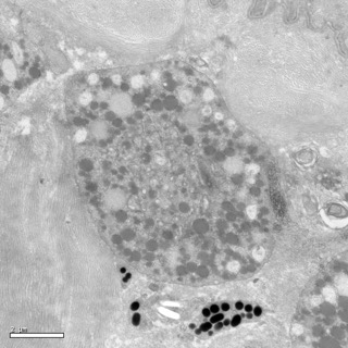 透射電鏡：一種動物的黃色素細(xì)胞2 Small Small
