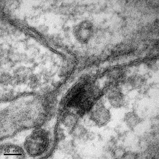 透射電鏡：一種動物的神經突觸 Small Small