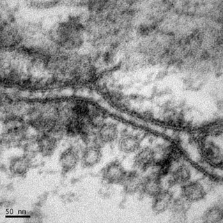 透射電鏡：一種動物的神經突觸2 Small Small