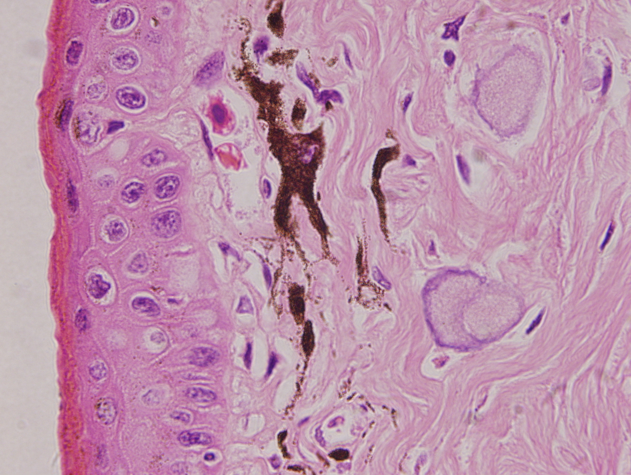 H.E 染色：一種動(dòng)物的黑色素