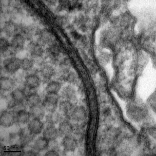 透射電鏡：一種動物的突觸前膜和突觸后膜 Small