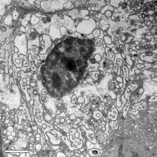 透射電鏡：一種動物的腺體 Small Small