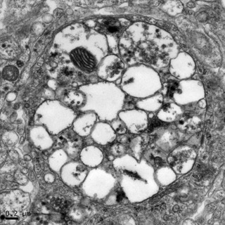 透射電鏡：一種動物腦內(nèi)的自噬小體 Small Small