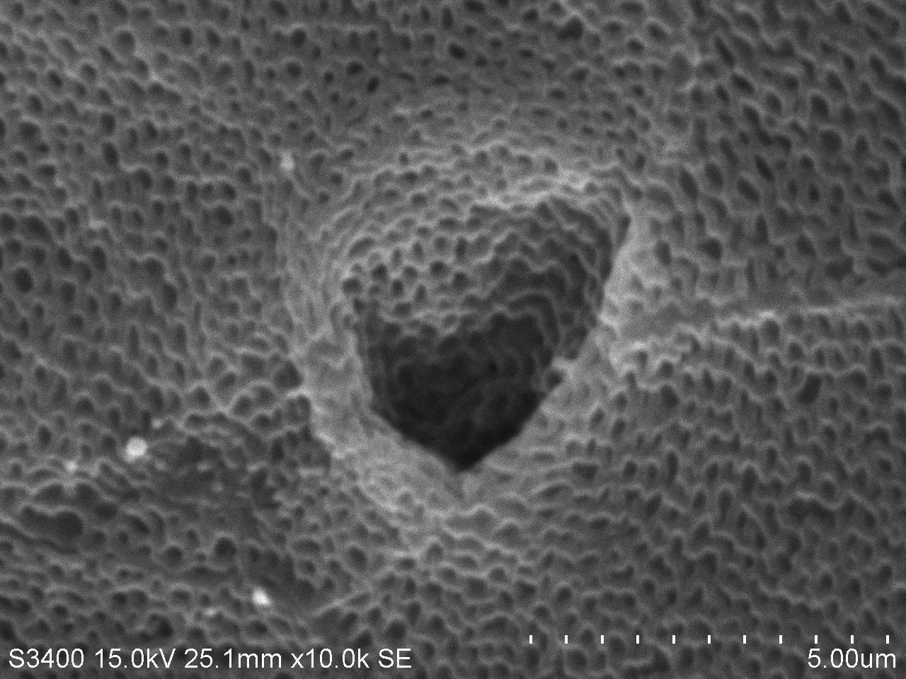 掃描電鏡： 一種動物的腺體